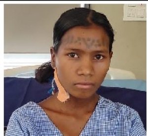जटिल बीमारी के चलते जीने की उम्मीद खो चुकी पंडरिया के सुदूर वनाचंल की सुखबति बैगा को मिला नवजीवन