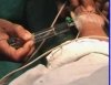 नारको टेस्ट के लिए छत्तीसगढ़ हुआ आत्म निर्भर, एम्स में नारको टेस्ट की मिली मंजूरी