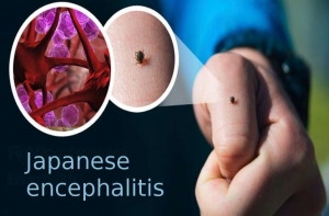 2 लाख से अधिक बच्चों का होगा टीकाकरण ,ज़िले में 23 नवंबर से 18 दिसंबर तक चलेगा जेई टीकाकरण अभियान