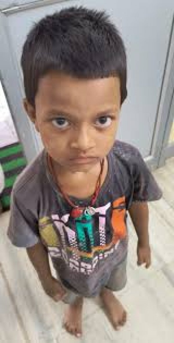 मासूम के गले में फंसे सिक्के को डॉक्टरों ने सफलतापूर्वक निकाला, समय पर उपचार से बची जान