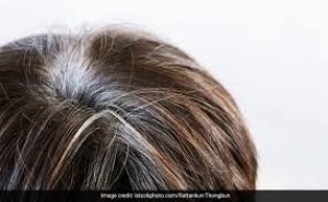 सफेद बालों को जड़ों से काला करने लगती हैं ये चीजें, धीरे-धीरे सिर से गायब होने लगती है सफेदी