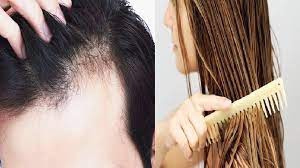 सर्दियों में बालों के झड़ने से हैं परेशान तो इन अचूक और आसान घरेलू नुस्खों को अपनाकर पाएं Hair Fall से निजात