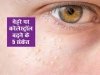 गंदा कॉलेस्ट्रोल बढ़ने से चेहरे पर नजर आ सकते हैं ये 5 लक्षण, समय रहते इस तरह कर लें पहचान
