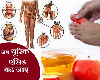 30 की उम्र के बाद तेजी से बढ़ता है , किडनी पर भी पड़ता है असर,जानिए क्&zwj;या खाएं क्&zwj;या नहीं