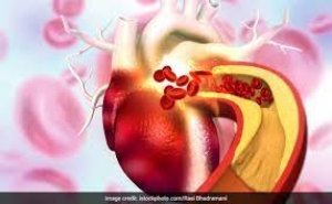 High Cholesterol को जल्द कंट्रोल करने के लिए अपनाएं ये 7 कारगर तरीके फिर और कुछ करने की जरूरत ही नहीं