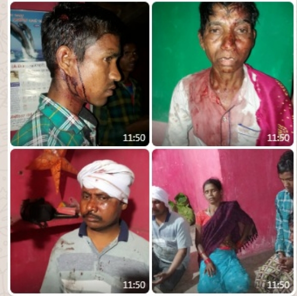 समाज विशेष के परिवारों पर अज्ञात लोगो द्वारा हमला , जाँच में जुटी पुलिस