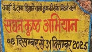 जिले में सघन कुष्ठ जांच खोज अभियान 31 दिसंबर तक