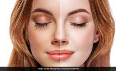 स्किन टैन को दूर करने के लिए अपनाएं ये घरेलू उपाय, निखर जाएगा चेहरा