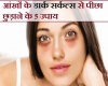 डॉर्क सर्कल से है परेशान तो आज ही आजमाएं ये ब्यूटी हैक्स