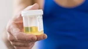 मुंह और नाक के बाद अब यूरिन के सैंपल से होगी कोरोना के लक्षणों की पहचान