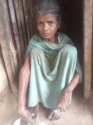 काग़ज़ों में हटाई गई, ज़मीन पर भूखी: विकलांग महिला राशन से वंचित