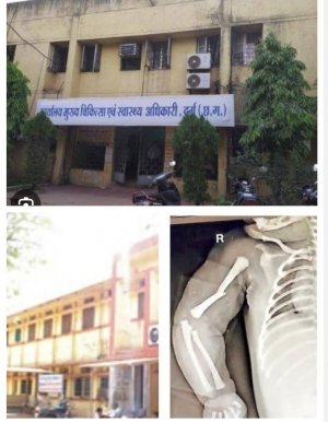 दुर्ग जिला अस्पताल में लापरवाही पर कब गिरेगी गाज? नवजात की टूटी हड्डियां, जिम्मेदारों पर कार्रवाई अब भी सवालों में!