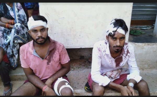 फल बेचने वाले दो सगे भाईयों पर प्राणलेवा हमला ,लूट लिए पास में रखे 5 हजार, ऑटो में की तोडफ़ोड